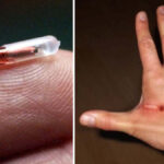 microchip sottocutanei